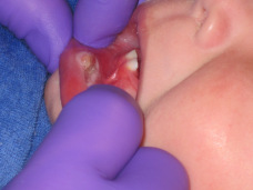 dental care for babies